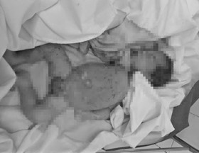 Tiền Giang: Bắt giữ cô gái 19 tuổi mang balo chứa thi thể bé sơ sinh